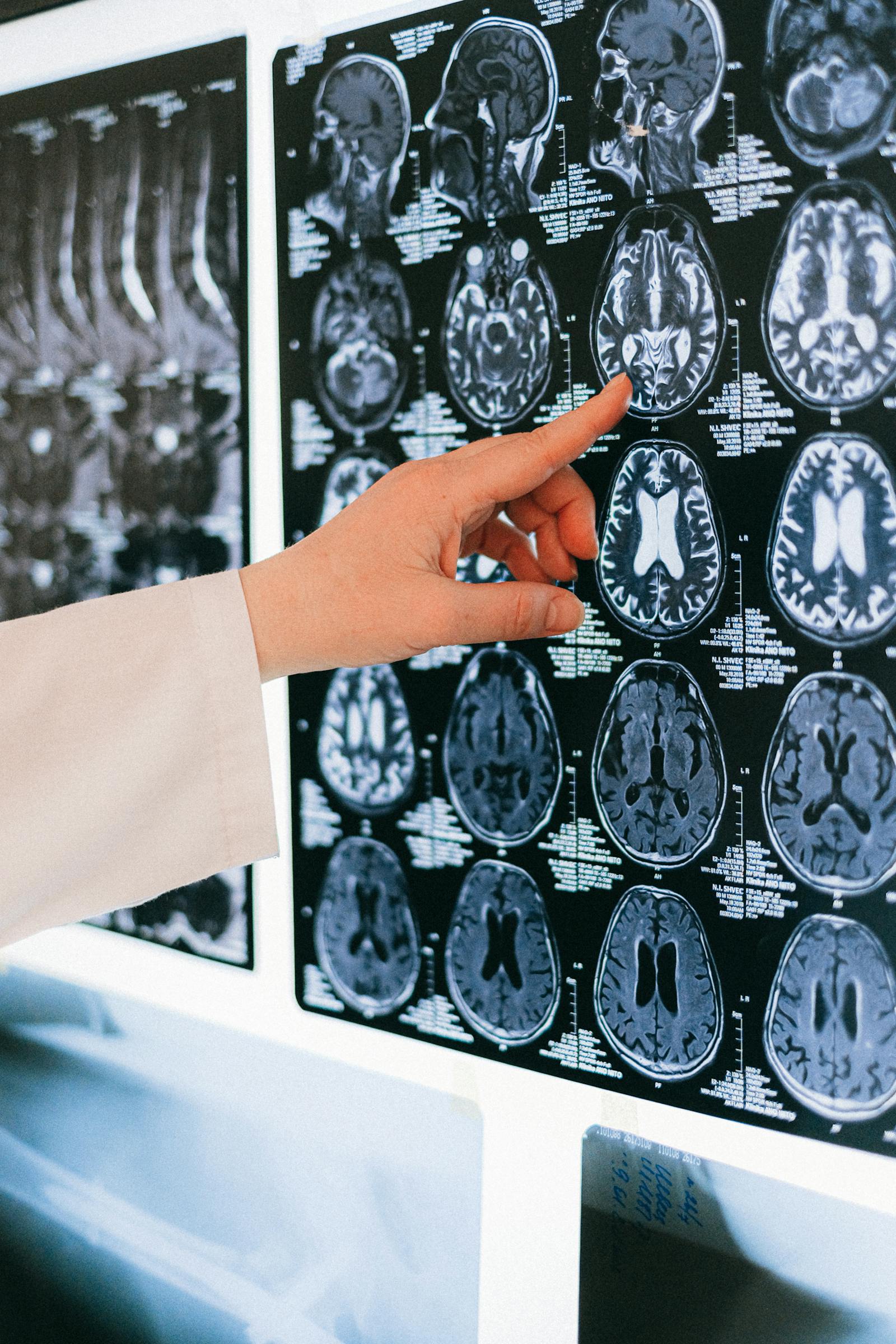 Imagerie médicale